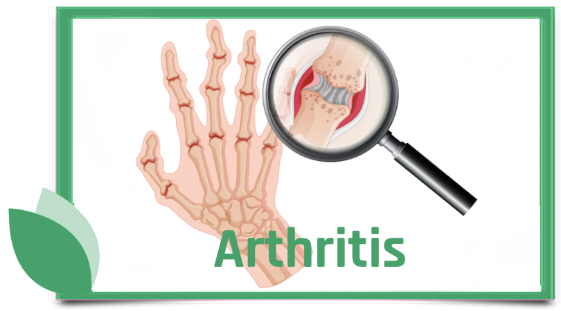 Arthritis - Symptome, Behandlung